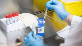 Con el reporte de otras 412 víctimas fatales, Argentina superó las 65 mil muertes por coronavirus