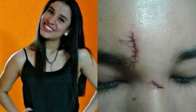 La joven y la herida en el rostro tras ser atacada por un desconocido en un bar.