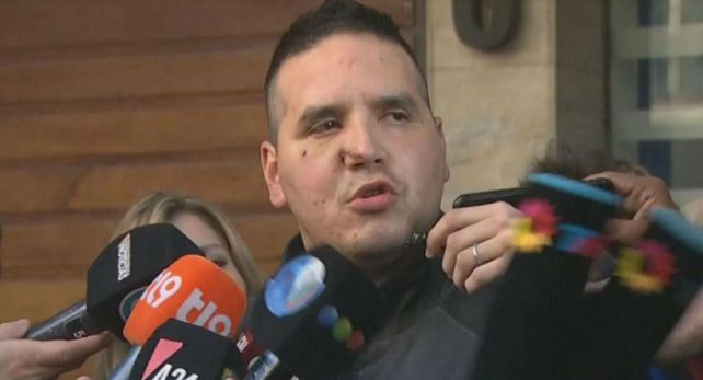 Las esquirlas provocaron heridas en el rostro del oficial Gómez