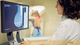 Las mujeres inscriptas recibieron traslado sin costo, garantizando accesibilidad total para quienes necesitaban el estudio.