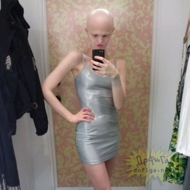 Conocé a la modelo internacional con una mutación genética única