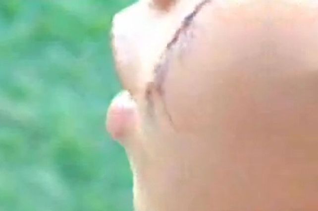 Río Negro: amenazan por Facebook y desfiguran a una chica por careta