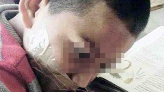 Una maestra le encintó la boca a alumno porque no paraba de hablar