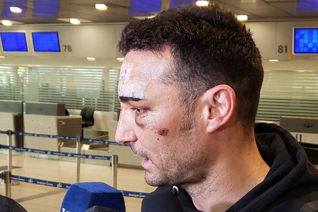 Scaloni regresó al país y habló del accidente que sufrió en España