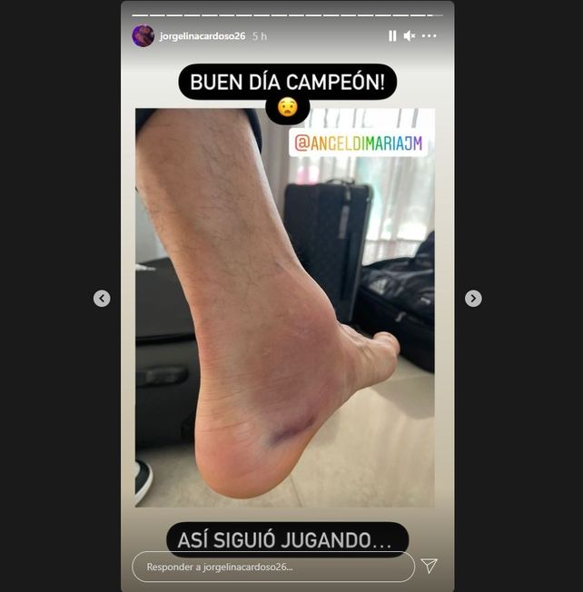 La mujer de Di María mostró cómo le quedó el tobillo a Angel tras la final