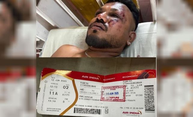 La policía confirmó que encontró un sobreviviente en el asiento 11A del avión de Air India que se estrelló La policía confirmó que encontró un sobreviviente en el asiento 11A del avión de Air India que se estrelló
