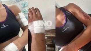 Otro brutal ataque de un perro pitbull. Esta vez ocurrió en la zona de San José del Rincón y la víctima sufrió fuertes mordeduras.