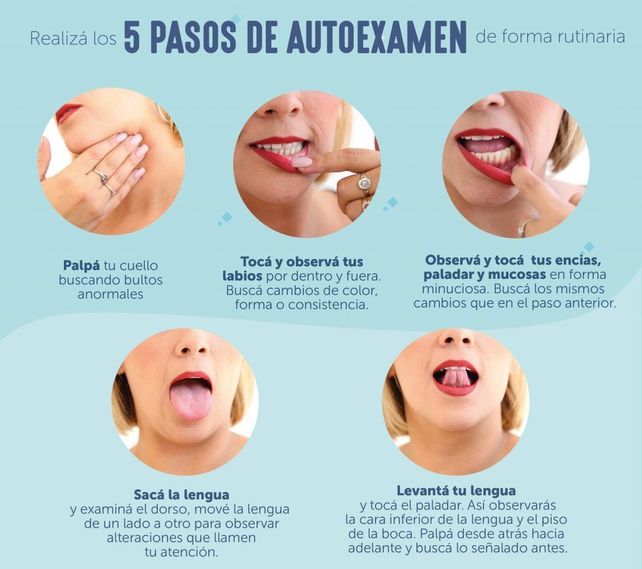Los cánceres de boca y cuello están entre los más curables en el país