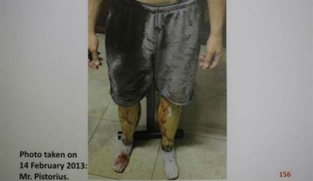 Inéditas y sangrientas fotos del caso Pistorius