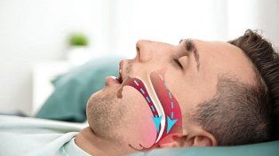 Apneas de sueño: de qué se trata, los riesgos y cómo prevenirla