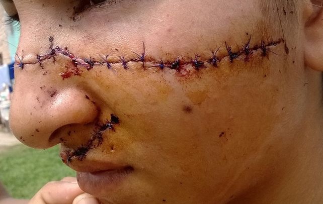 El salvaje episodio ocurrió el viernes último en un barrio de la ciudad de Formosa e incluyó