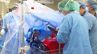 Enfrían el cerebro para salvar a pacientes muy graves