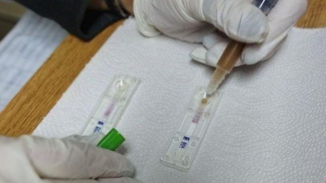 El Test de Sangre Oculta sirve para detectar la presencia de sangre no visible en la materia fecal.