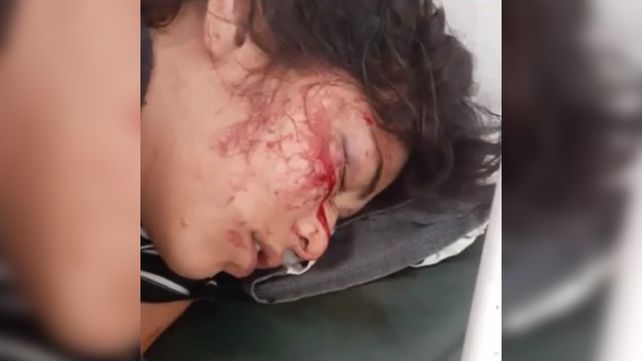 Una mujer se quejó porque estaban tirando tiros al aire y casi le sacan un ojo de un piedrazo
