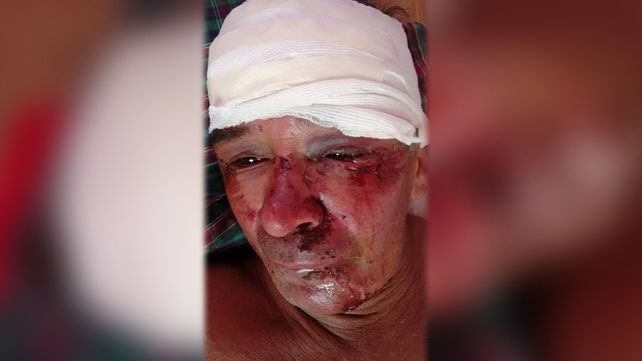 Brutal ataque a un hombre en la ciudad de Reconquista