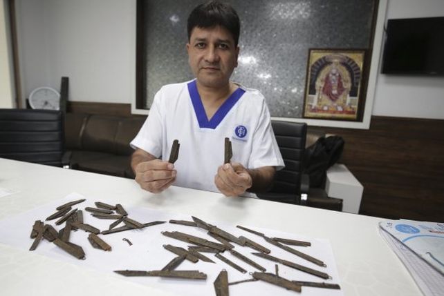 Fue al médico por un fuerte dolor abdominal y lo operaron para sacarle 40 navajas de la panza