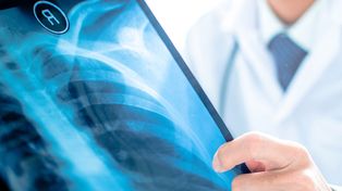 Día Internacional de la Radiología