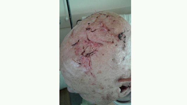 Cerrito: salvaje agresión a un almacenero