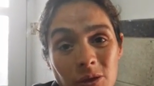 Espera. María de los Ángeles, madre del niño, dijo que aguardan la evolución de su hijo para la segunda cirugía.