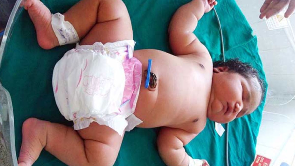 El Bebe Mas Grande Del Mundo Nacio En La India Con 7 Kilos De Peso Y Por Cesarea