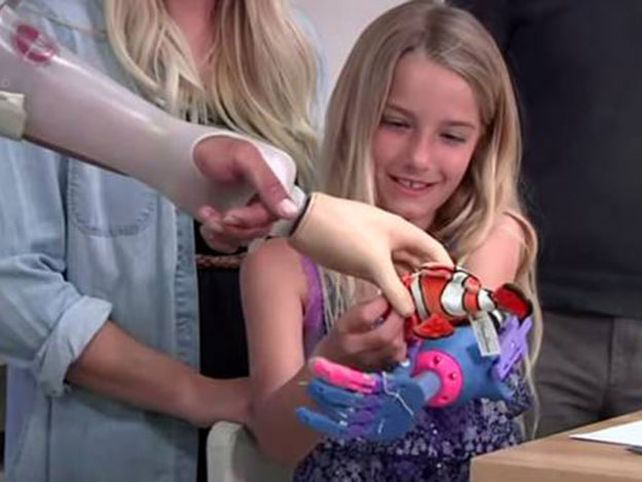 Impresión en 3D permite a niña tener prótesis de mano