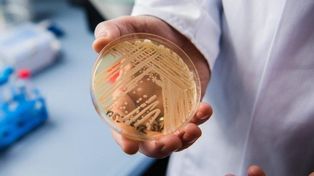 Atentos. En los centros de salud supervisan posibles casos de infección por cándida auris