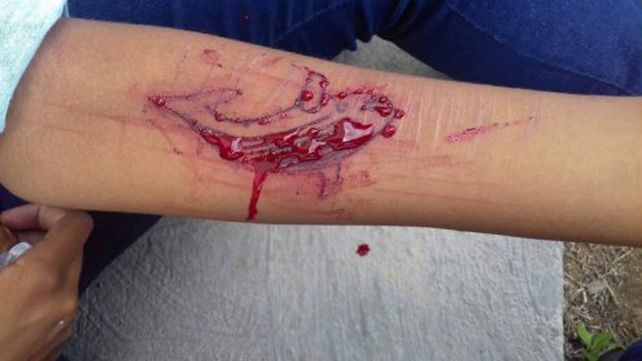 Similar a la ballena azul. El mecanismo de instigación llevaba al peor final.