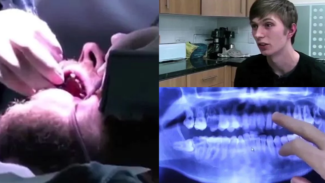 Mostró sus dientes luego de 20 años sin lavárselos