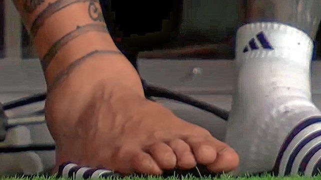 Así le quedó el tobillo a Messi