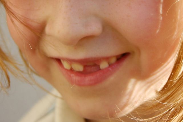 Conoce qué hacer con los dientes de leche