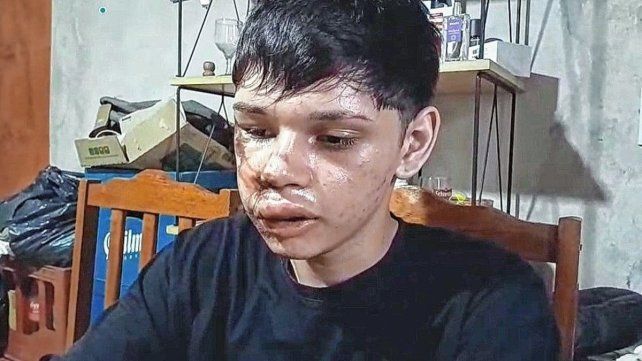 Concordia: adolescente denuncia agresión policial tras chocar con una camioneta.