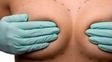Argentinas querellan a tres empresaas europeas por implantes mamarios