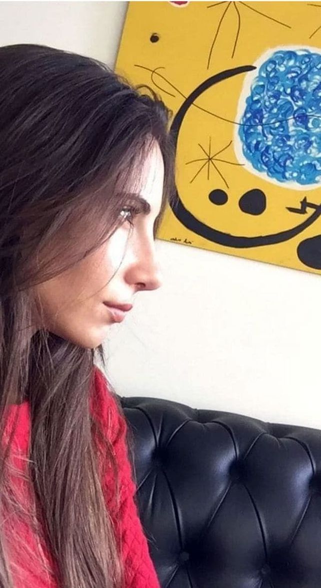 Magui Bravi al fin publicó fotos de su nueva nariz aunque sigue sin hablar de Suar