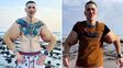 El Popeye ruso: se inyectó vaselina en los biceps y ahora puede perder ambos brazos