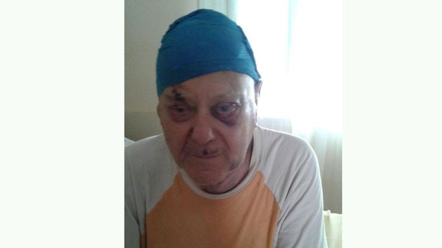 Golpiza. El agresor le pegó a don Basso con una banqueta