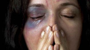 Le dio una brutal golpiza a su pareja