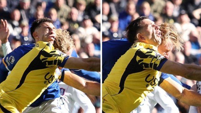 Emiliano Dibu Martínez recibió un cabezazo y fue retirado en camilla en el partido de Everton y Chelsea