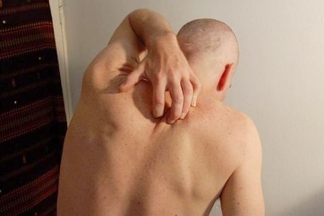 La picazón es tan contagiosa como el bostezo