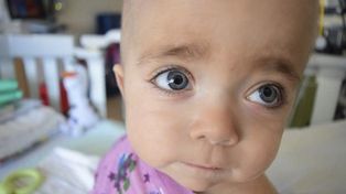 Murió Helenita, la beba argentina que recibió dos trasplantes de médula