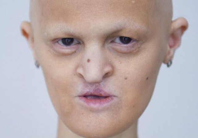 Conocé a la modelo internacional con una mutación genética única