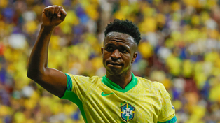 Vinícius reapareció con un sorprendente cambio facial: así quedó tras un retoque estético