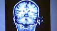 La p&eacute;rdida de la capacidad cognitiva puede comenzar a los 45 a&ntilde;os