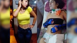 Ayelén Luna. La joven santafesina necesita viajar con urgencia a China para realizarse un tratamiento con células madres producto de una parálisis cerebral.