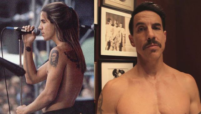 Anthony Kiedis