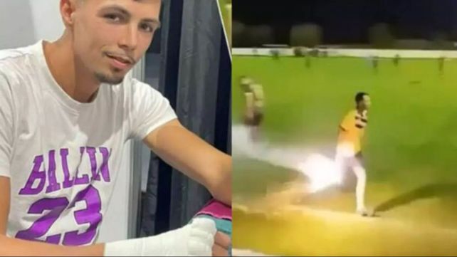 El jugador del fútbol de Bélgica fue atendido de urgencia tras intentar sacar una supuesta bomba de humo