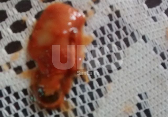 La Assal confirmó que lo encontrado en el puré de tomates no era un dedo