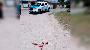 Murió en el hospital el joven baleado en Bajada Grande