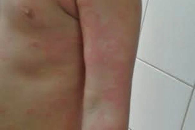 Internaron a un nene que consumió ketchup con un mes de vencimiento