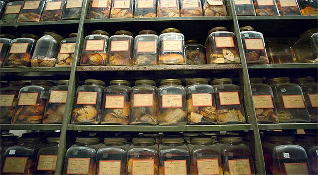 Entre los cerebros desapareidos estaba el del famoso francotirador de Texas