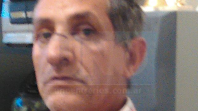 A Omar González le hicieron cinco puntos en la zona del tabique: La saqué barata. La puedo contar